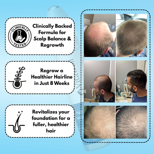 Hair Growth Serum - for Thicker & Stronger Hair