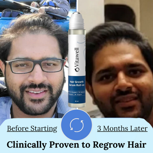 Hair Growth Serum - for Thicker & Stronger Hair
