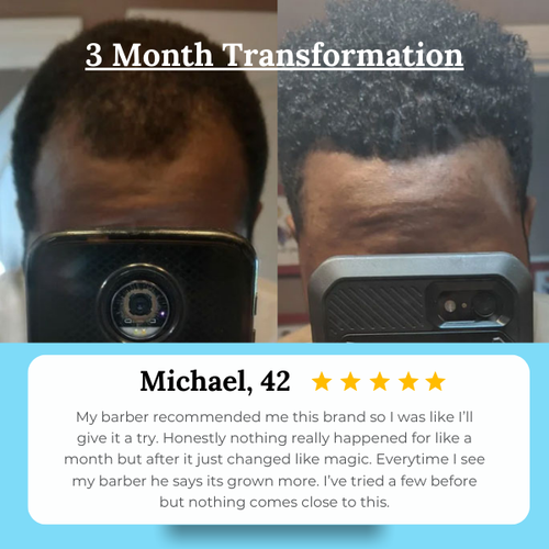 Hair Growth Serum - for Thicker & Stronger Hair